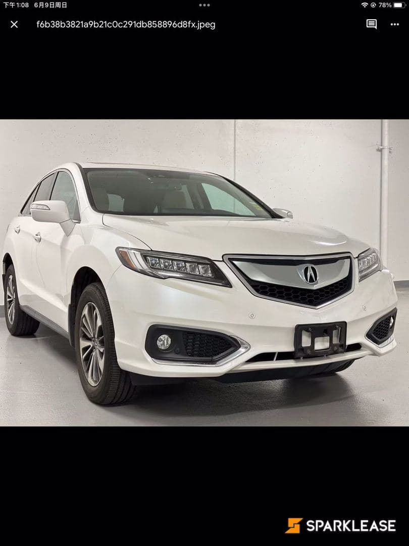 2017 Acura RDX AWD 4dr Elite Pkg