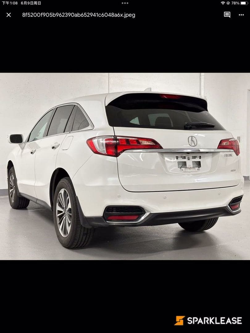2017 Acura RDX AWD 4dr Elite Pkg