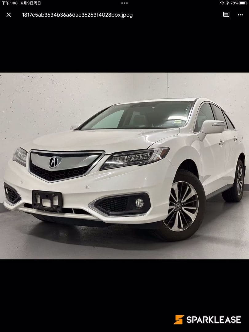 2017 Acura RDX AWD 4dr Elite Pkg